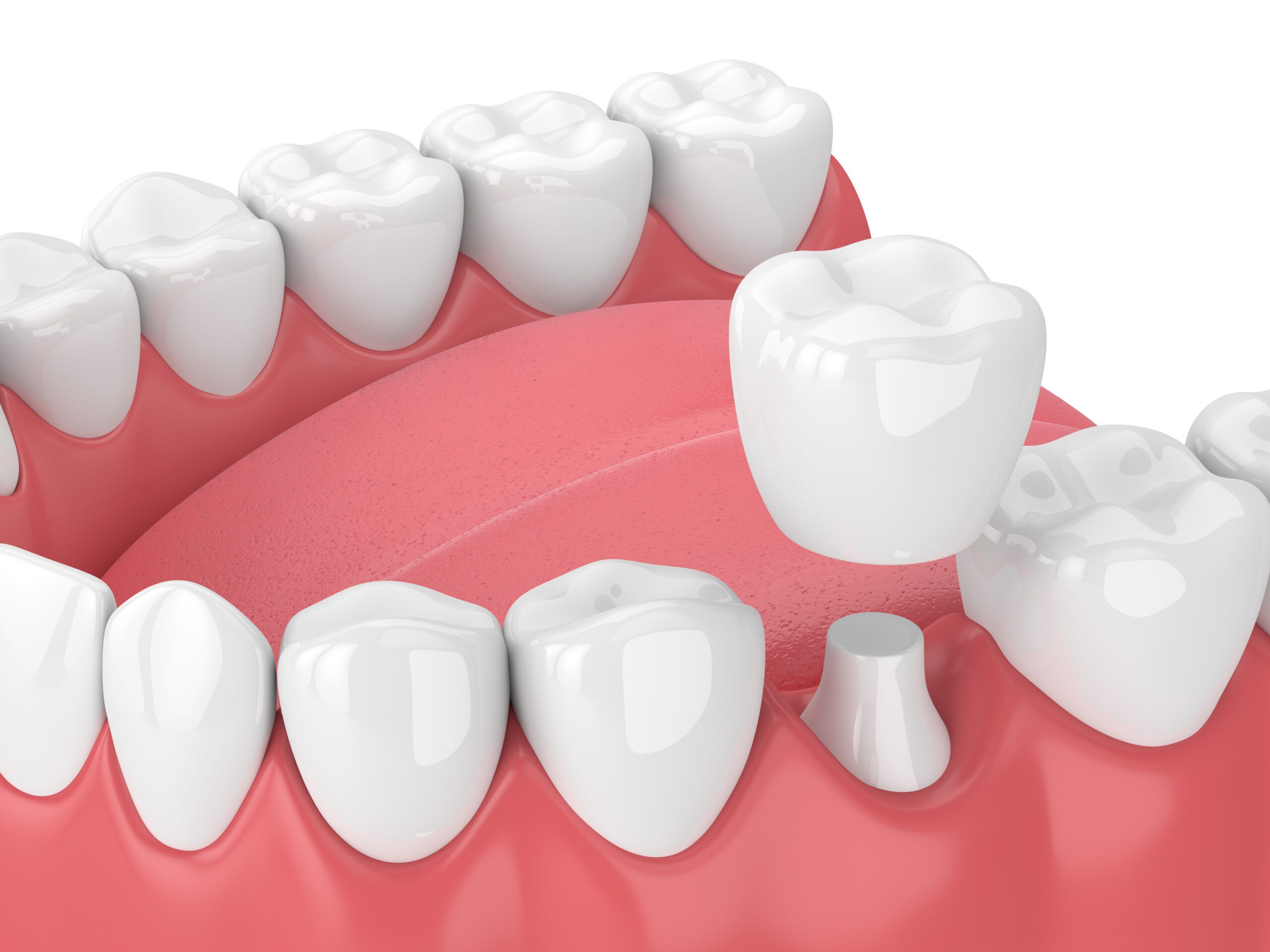 Salt Lake City dental