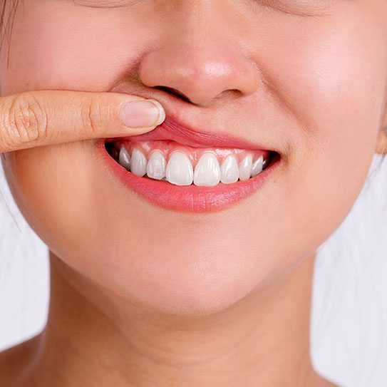 Olympus View Dental -