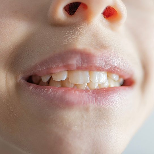 Olympus View Dental -
